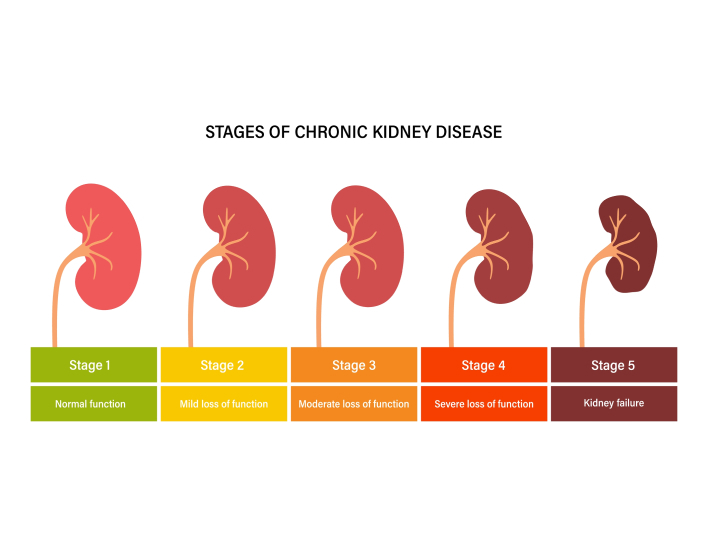 kidney disease chart